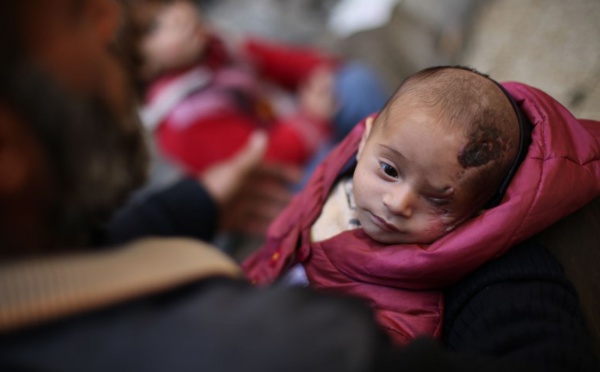 Syrie: un bébé devenu borgne après un raid, symbole sur le net