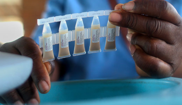 Mayotte: 210 cas de choléra, un nouveau foyer identifié