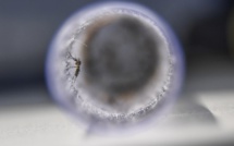 Zika: le 1er trimestre de grossesse est la "période à risque" selon une étude française
