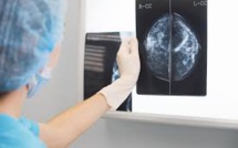GB: une erreur dans le dépistage du cancer du sein aurait écourté 270 vies