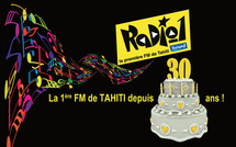 La FM 100 (Radio1) fête son 30ème anniversaire