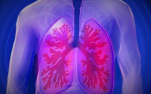 Cancers du sein, du poumon et du pancréas: de nouveaux traitements encourageants