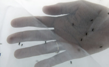 L’épidémie de dengue à Saint-Martin provoque un premier décès