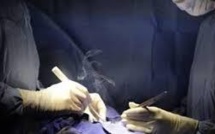 GB: un chirurgien soupçonné d'avoir écrit ses initiales sur le foie d'un patient