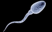 Des spermatozoïdes vieux de 17 millions d'années découverts en Australie