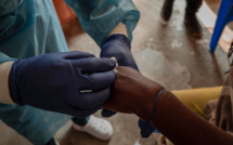 Mpox: le premier cas en Asie accroit les craintes d'une propagation mondiale