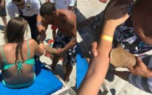 Floride: une nageuse emmenée à l'hôpital avec un requin mordant encore son bras